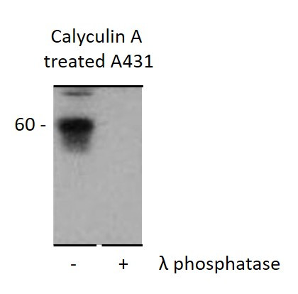 Anti-phospho-CORO1B (Ser2)