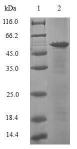 Histone chaperone ASF1A (ASF1A), human, recombinant