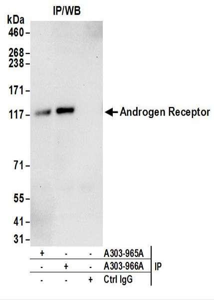 Anti-Androgen Receptor
