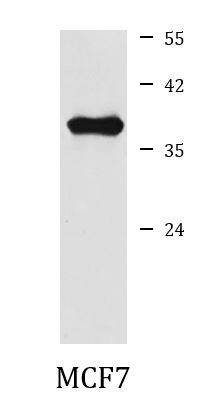 Anti-NTHL1