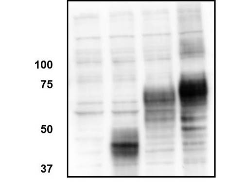 Anti-ORAI-1