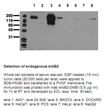 Anti-ErbB2 (intracellular domain aa 860-880), clone 24B5