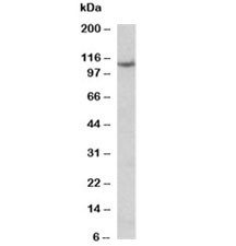 Anti-Thyroid peroxidase