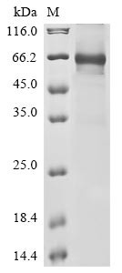 Complement component C8 beta chain (C8B), human, recombinant