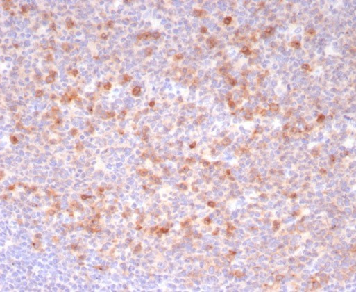 Anti-CD269 / TNFRSF17 / BCMA (B-Cell Maturation Protein), recombinant antibody, clone CD269/8190R