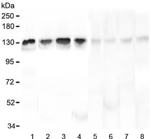 Anti-Leucyl tRNA synthetase / LARS