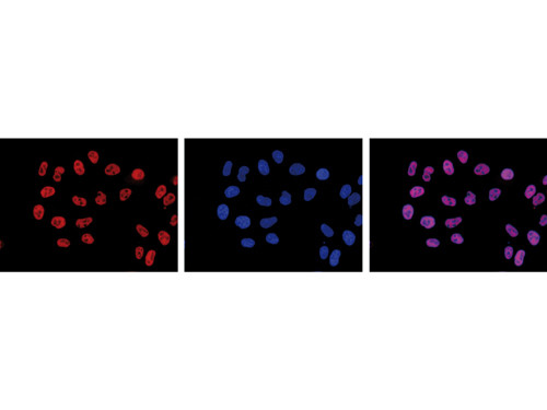 Anti-phospho-Pol II (Ser2), clone