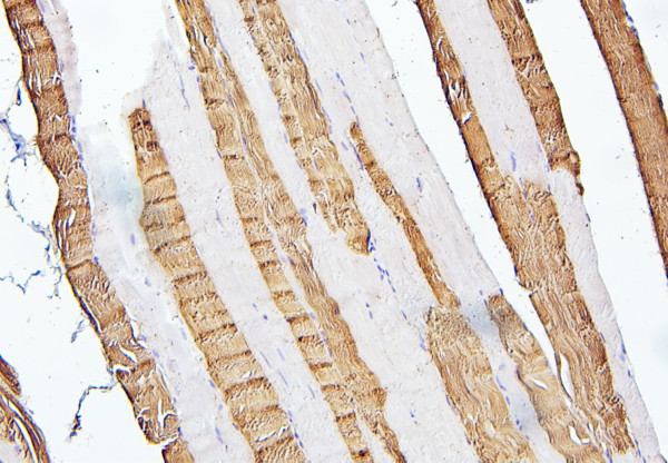 Anti-TNNI2