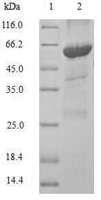 Phytanoyl-CoA dioxygenase, peroxisomal (PHYH), human, recombinant
