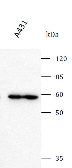 Anti-B56 beta