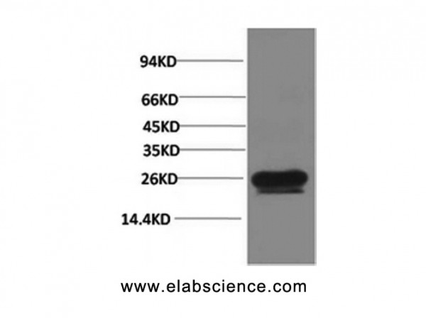 Anti-HSP27, clone 3E5