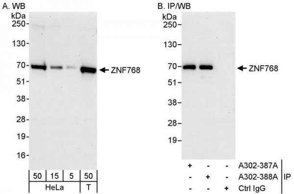 Anti-ZNF768