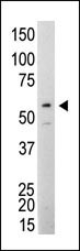Src Family Protein Tyrosine Kinases Antibody Panel
