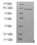 Heterogeneous nuclear ribonucleoprotein H (HNRNPH1), human, recombinant