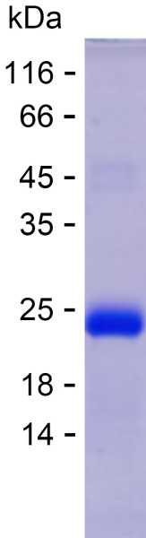 Recombinant Human CHODL Protein