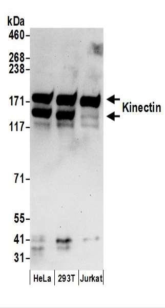 Anti-Kinectin