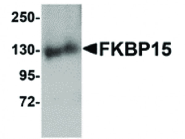 Anti-FKBP15