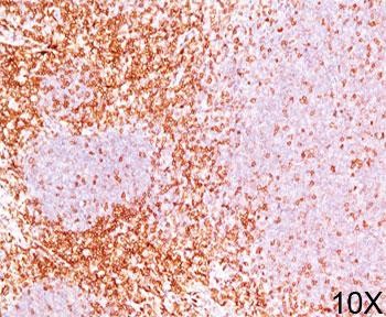 Anti-CD6, clone 3F7B5