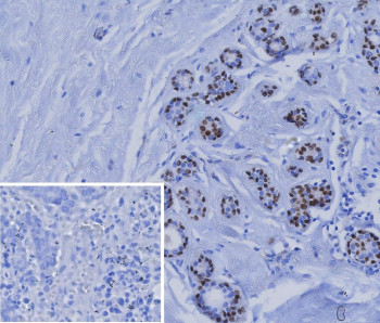 Anti-SOX10 / Transcription factor SOX10, clone rSOX10/991