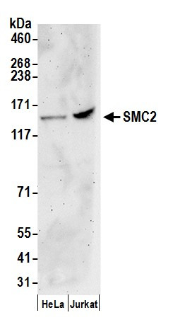 Anti-SMC2