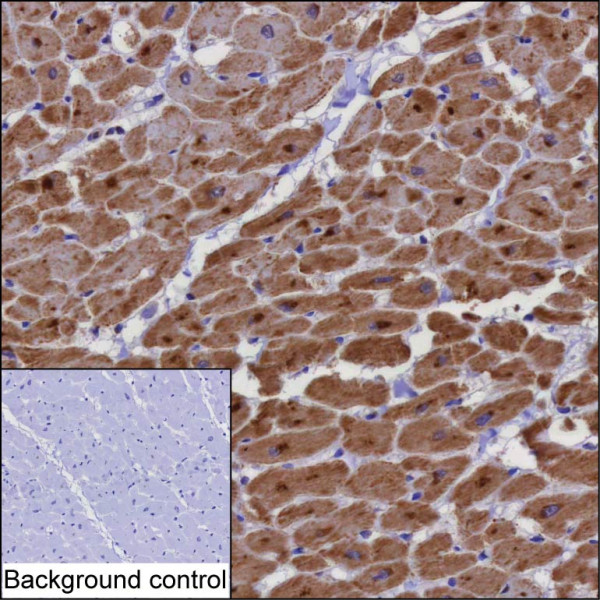 Anti-PTGES2
