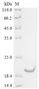 Spectrin beta chain, non-erythrocytic 1 (Sptbn1),partial, mouse, recombinant