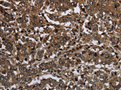 Anti-GLIPR1
