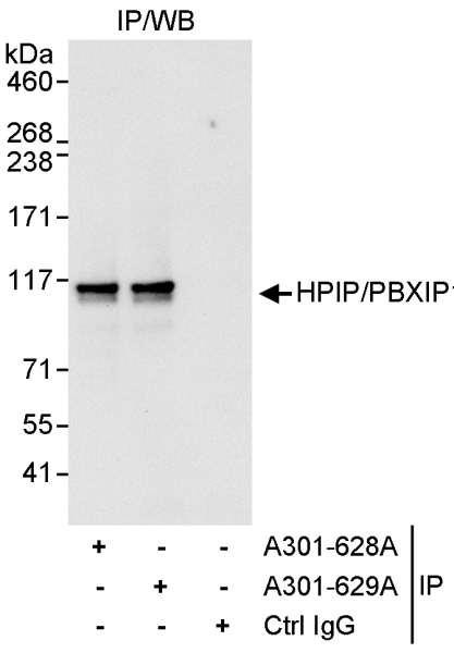 Anti-HPIP