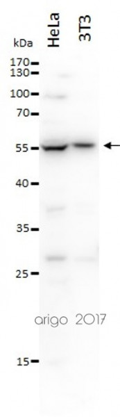 Anti-PPAR gamma