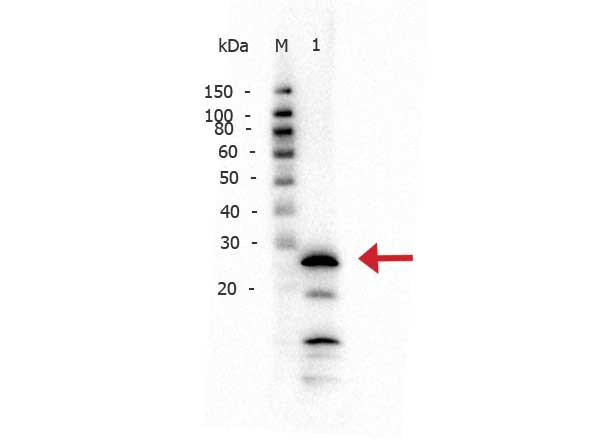 Anti-TRYPSIN