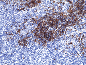 Anti-Terminal deoxynucleotidyl transferase (human), Rabbit Monoclonal (RM379)