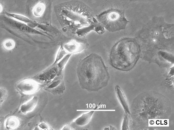 RCC-PR Cells