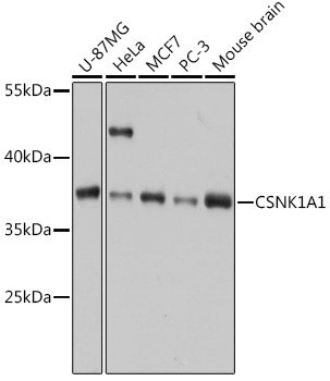 Anti-CSNK1A1