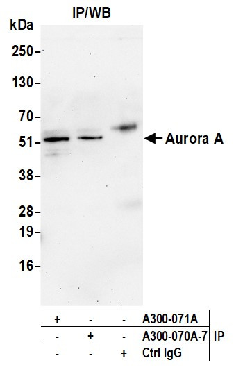 Anti-Aurora A