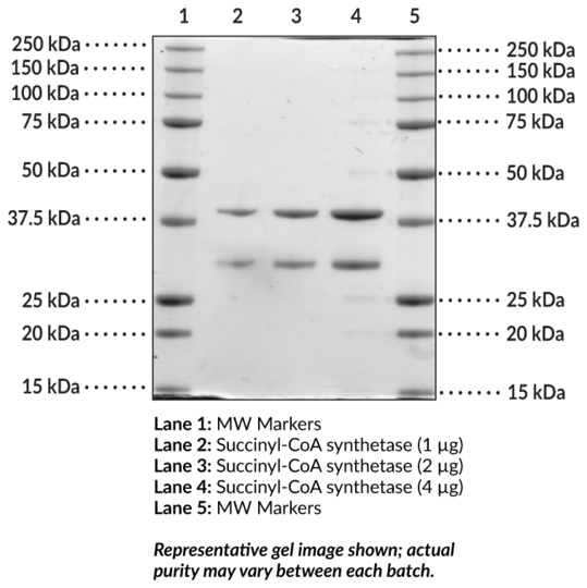 Succinyl-CoA synthetase