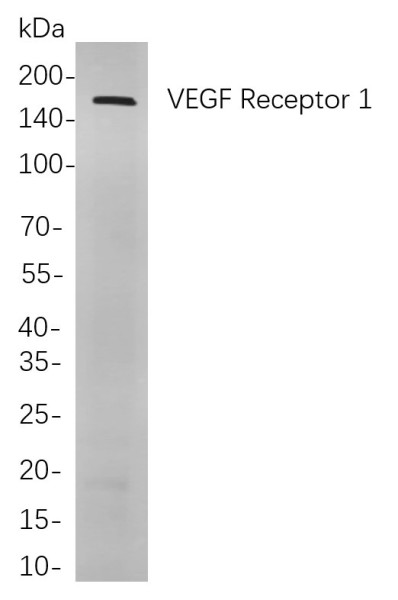 Anti-Recombinant VEGF Receptor 1, clone 1A8