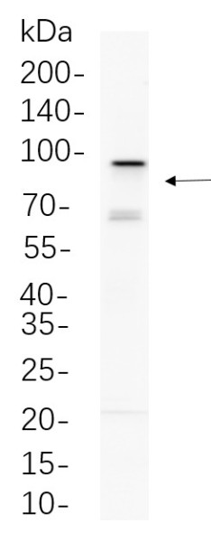 Anti-Recombinant EZH2, clone 12G12
