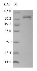 L-dopachrome tautomerase (DCT), partial, human, recombinant