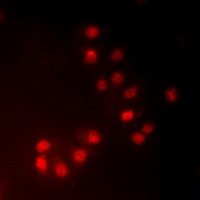 Anti-phospho-MKI67IP / NIFK (Thr234)