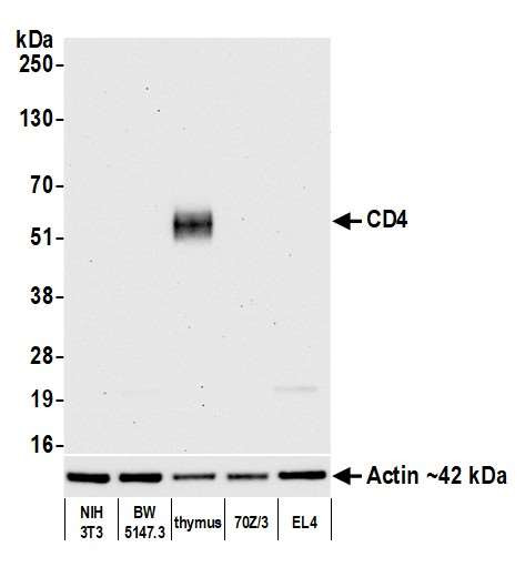 Anti-CD4 Recombinant Monoclonal