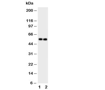 Anti-GABA A Receptor alpha 1