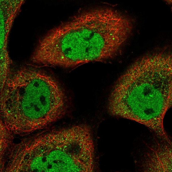 Anti-ARMC8