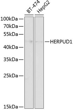 Anti-HERPUD1