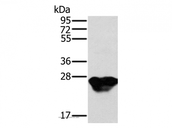 Anti-MYL3