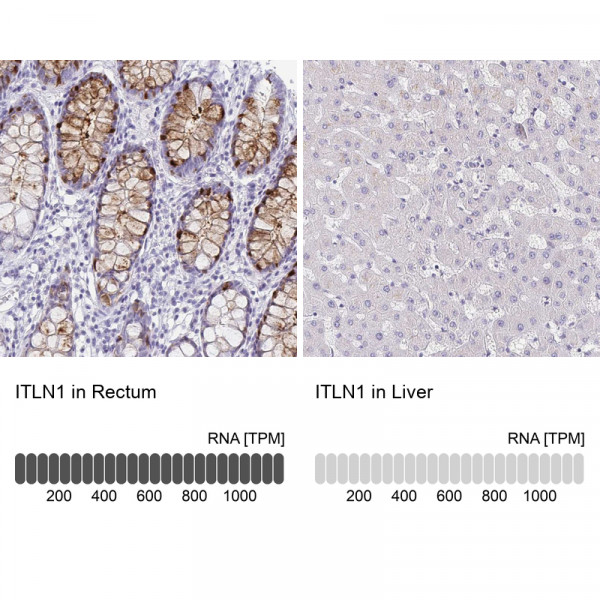 Anti-ITLN1