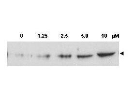 Anti-phospho-Chk2 (Thr68) (Checkpoint Kinase 2, Rad 53)