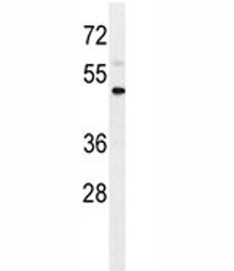 Anti-IL1R2