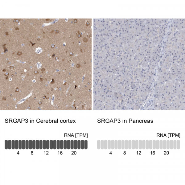 Anti-SRGAP3