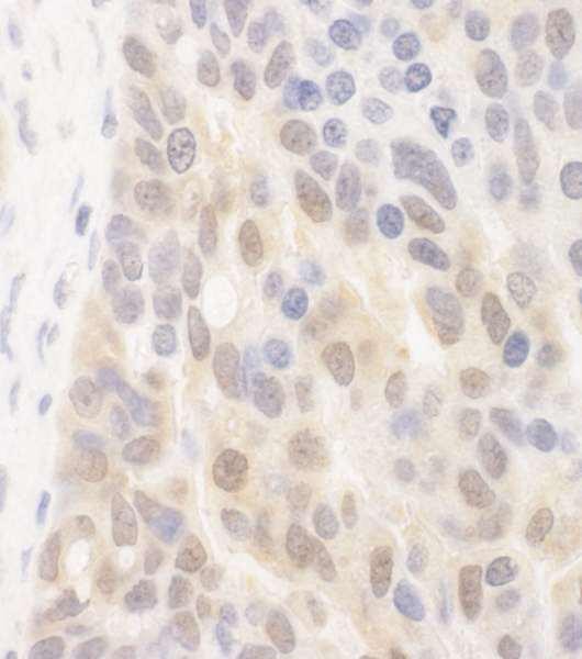 Anti-SPATA2 (IHC)