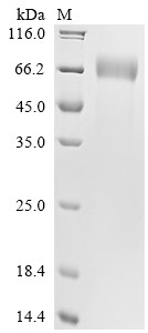 Interferon gamma receptor 1 (IFNGR1), partial, human, recombinant